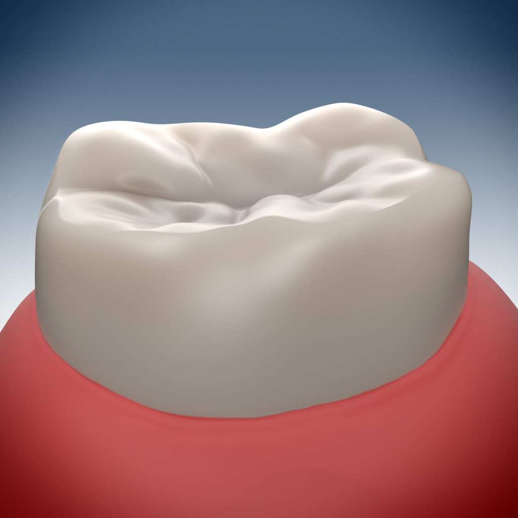 A computerized image of a molar